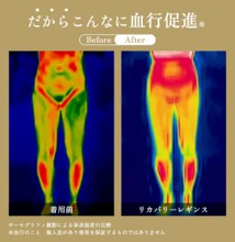 ヒーロジーのリカバリーレギンスの血行促進効果